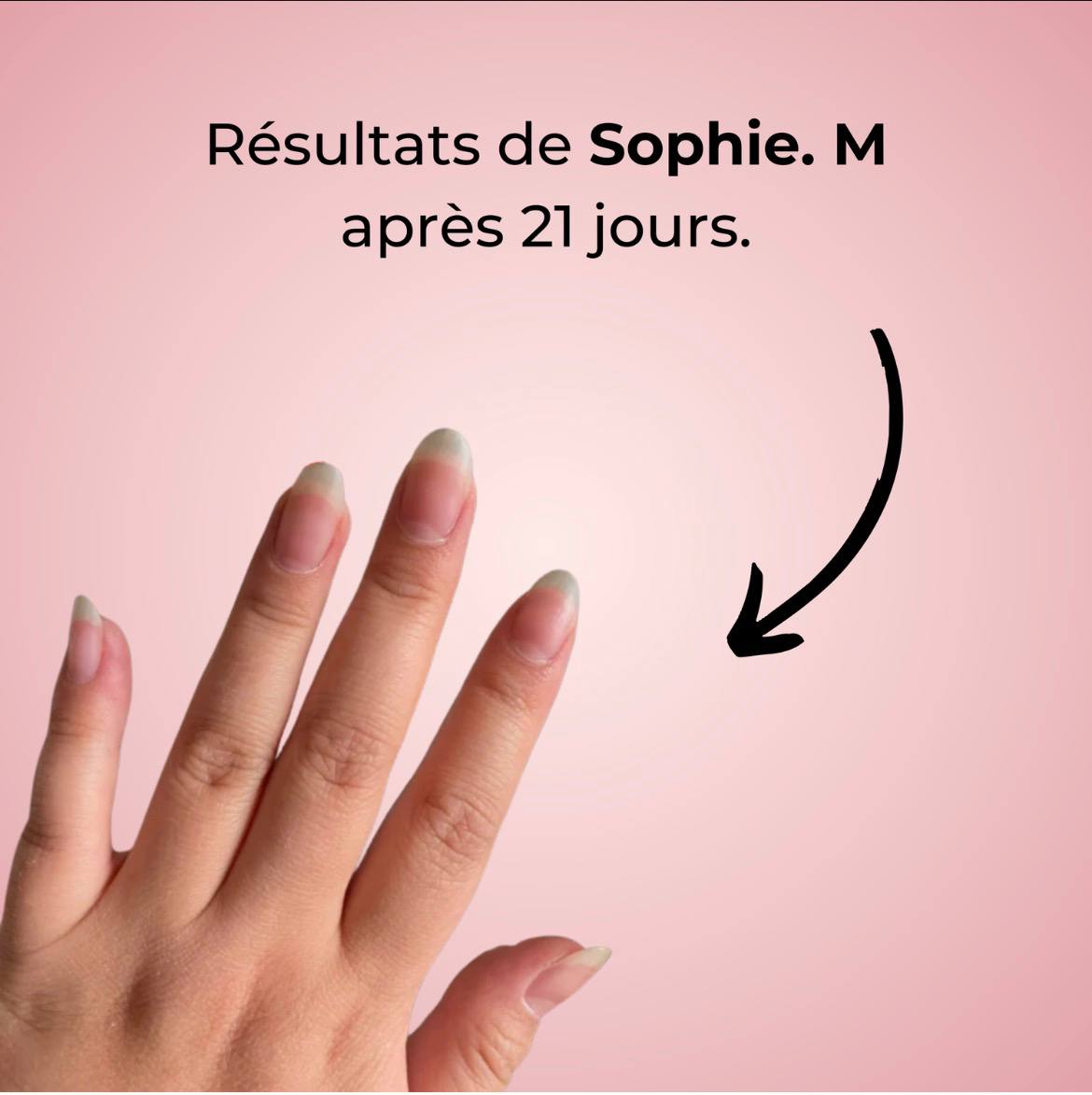 SÉRUM DE CROISSANCE DES ONGLES (1 ACHETÉ = 1 OFFERT)