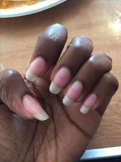 SÉRUM DE CROISSANCE DES ONGLES (1 ACHETÉ = 1 OFFERT)